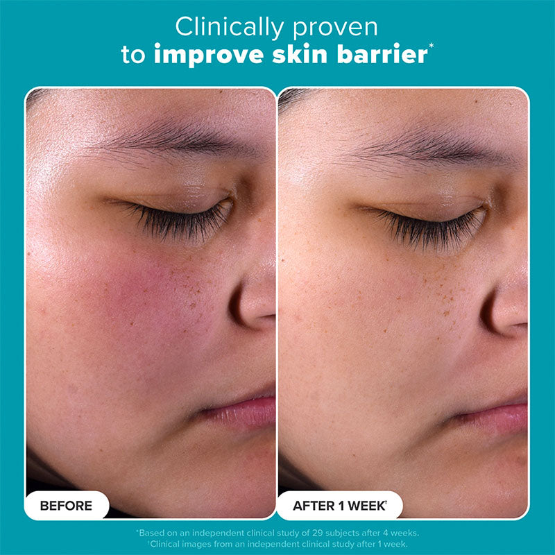 2% BHA Liquid Exfoliant