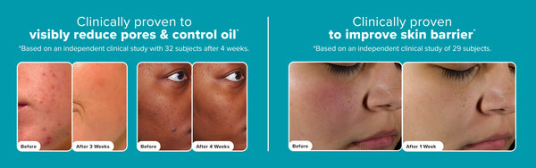 skin perfecting 2 bha liquid exfoliant