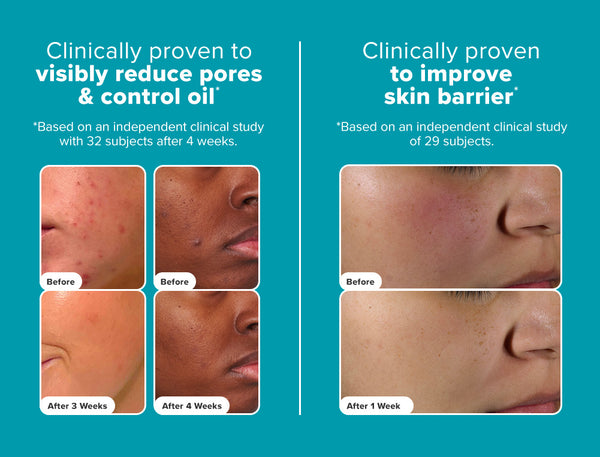 skin perfecting 2 bha liquid exfoliant